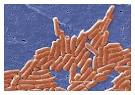 <b>Salmonella Typhimurium</b>