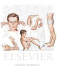 <b>Ehlers</b>-<b>Danlos Syndrome</b>