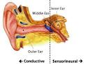 Audiology > <b>hearing loss</b> Types