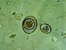 Imagenes <b>Isospora</b>