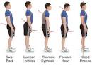 <b>Lordosis</b> Treatment