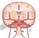 <b>Intracranial Hemorrhage</b>