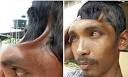 Twenty-four-year-old Mohd Izanuddin Hisham Muhamad lost half his skull in a ... - 70914036