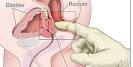 Otros, como <b>la</b> edad de <b>la</b>