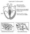 Health-e-Child - IST-2004-027749 - D.11.4 - Paediatric Heart Diseases