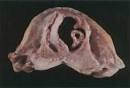 Caninum.