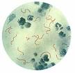<b>Rheumatic fever</b>