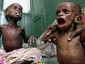 Malnourished Somali children in Mogadishu The public has responded amazingly ... - somali-children