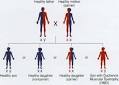 Muscular Dystrophy - body, contagious, causes, What Is Muscular ...