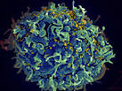 si-<b>HIV</b>.jpg. Fewer infections.