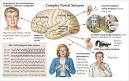 <b>Partial Epilepsy</b> Seizures