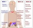 Multiple endocrine <b>neoplasia</b>.