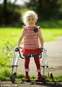 Cerebral palsy procedure: Girl, 4, denied operation to help her