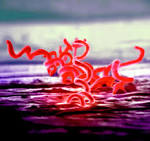<b>Treponema</b> pallidum- the agent