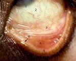<b>Conjunctiva</b> (named because it