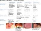 Del <b>tejido muscular</b>