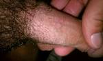 I have small bumps on my pubic area I am a 30 year old male ...