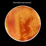 File:<b>Serratia marcescens</b> 01.
