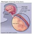 <b>Aseptic meningitis</b>