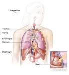 <b>non</b>-<b>small cell lung cancer</b>