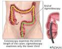 <b>Colonoscopy</b>