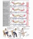 AIDP (<b>Guillain</b>-<b>Barre Syndrome</b>)