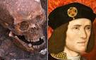 King RICHARD IIIs teeth and jaw reveal monarchs anxious life and.