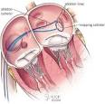 When is <b>pulmonary vein</b>