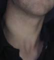 File:<b>Neck</b>.png