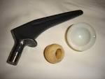 File:<b>Hip prosthesis</b>.jpg