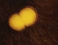 <b>Neisseria gonorrhoeae</b>