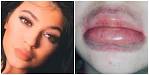 The Kylie Jenner Lips Challenge has swept Twitter, with truly.