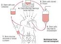 <b>Bone Marrow Transplant</b> Guide