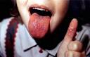 Hand, foot, and <b>mouth disease</b>: