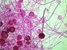<b>Rhizopus</b> Sporangia X 40.