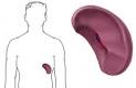 se llama <b>hiperesplenismo</b> y
