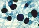 BIOL/CSES 4684 - <b>Rhizopus</b>