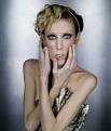 ISABELLE CARO, French model Dead set against-anorexia struggle ...