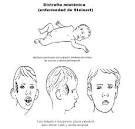 <b>Distrofia miotónica</b> de