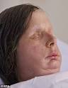 Charla Nash Reveals Face Transplant 3 Months On