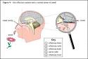 In <b>Kallmann's syndrome</b>, it is