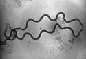 <b>Treponema</b> pallidum