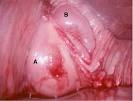 Case of the Month: July 2001