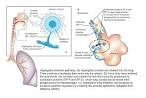<b>Aspergillosis</b>, a lethal severe