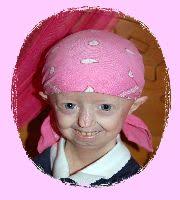 Welcome to Hayleys Progeria