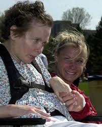 Huntingtons Disease have