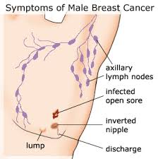 Breast Cancer Awareness Breast Cancer