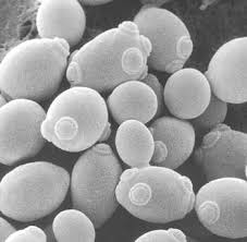 candida yeast infection relief