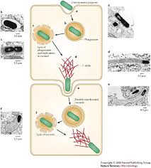 Listeria monocytogenes: a