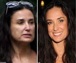 Demi Moore before and after